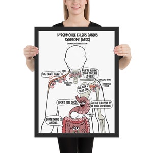 Funny hypermobile ehlers danlos syndrome (hEDS) cartoon Framed poster