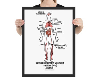 Síndrome de taquicardia ortostática postural (POTS) Póster divertido Póster enmarcado