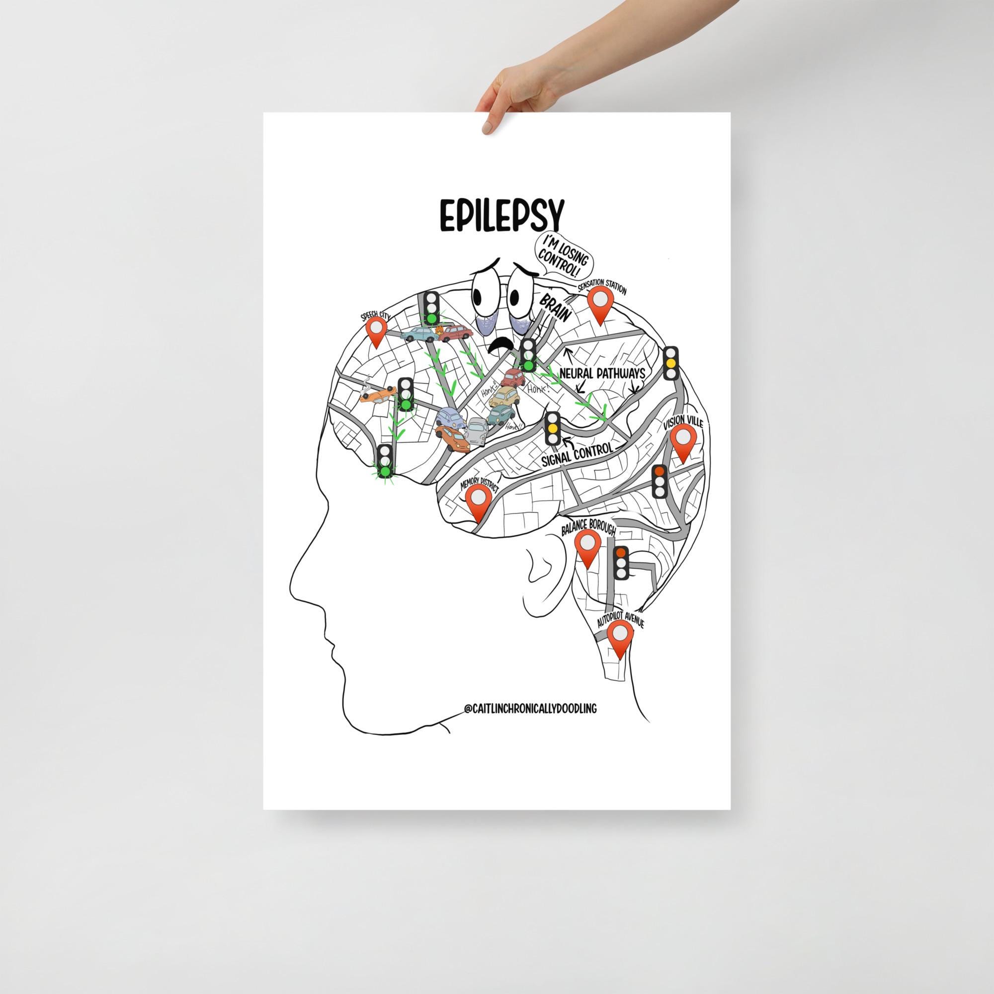 Epilepsy Explained Poster – Cartoon Brain Diagram | Medical ...