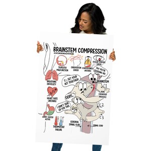 May include: A poster with the title "Brainstem Compression" and medical illustrations. The poster includes diagrams of the brainstem, spinal cord, and related symptoms such as breathing difficulty and unstable heart rate. The text includes "C1, get your act together!"