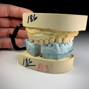 Hinged Plaster Cast Teeth Molds. Great Prop. & Aesthetic Dental Curiosity!