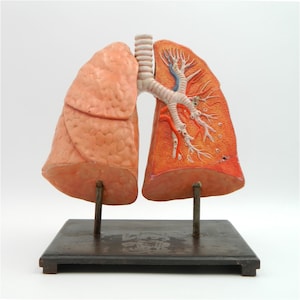 Op de afbeelding: Een vintage anatomisch model van menselijke longen op een zwarte metalen basis. Eén long is in doorsnede getoond, waardoor de interne structuur van de bronchiën en alveoli zichtbaar is.