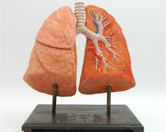 Puede incluir: Un modelo anatómico vintage de pulmones humanos sobre una base de metal negro. Un pulmón se muestra en sección transversal, revelando la estructura interna de los bronquios y los alvéolos.