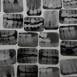 Xrays Dental Tooth Bone Films, Vintage Dental Xrays Film Panoramic, Dental Teeth Photography, Black and White Film, Medical Supplies, Images