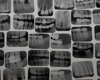 Xrays Dental Tooth Bone Films, Vintage Dental Xrays Film Panoramic, Dental Teeth Photography, Black and White Film, Medical Supplies, Images