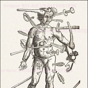 Ancienne illustration d'ex-libris du 16e siècle provenant d'un manuel de chirurgiens militaires médicaux scientifiques 5 x 7 carte de voeux