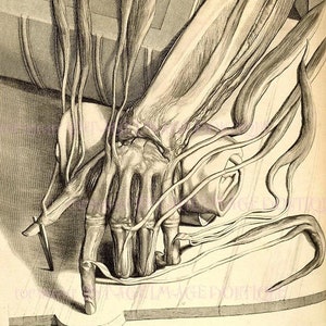 Antieke Georgische illustratie van een ontleed menselijke linkerhand en arm medisch-wetenschappelijke wenskaart van 5 x 7