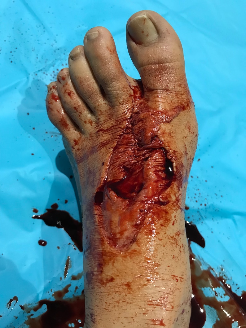 Entry & Exit Gun Shot Foot Wound: Two Piece Encapsulated Silicone Prosthetic image 1