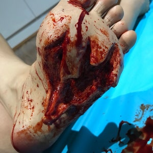 Entry & Exit Gun Shot Foot Wound: Two Piece Encapsulated Silicone Prosthetic image 2