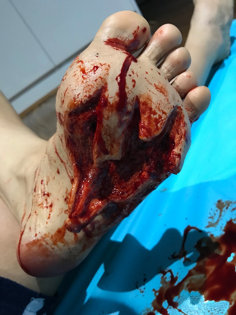 Entry & Exit Gun Shot Foot Wound: Two Piece Encapsulated Silicone Prosthetic image 2