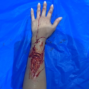 May include: A human arm and hand with simulated open wounds and blood. The arm is positioned on a blue surface, with the hand open and fingers extended. The wounds are detailed with realistic textures and coloring.