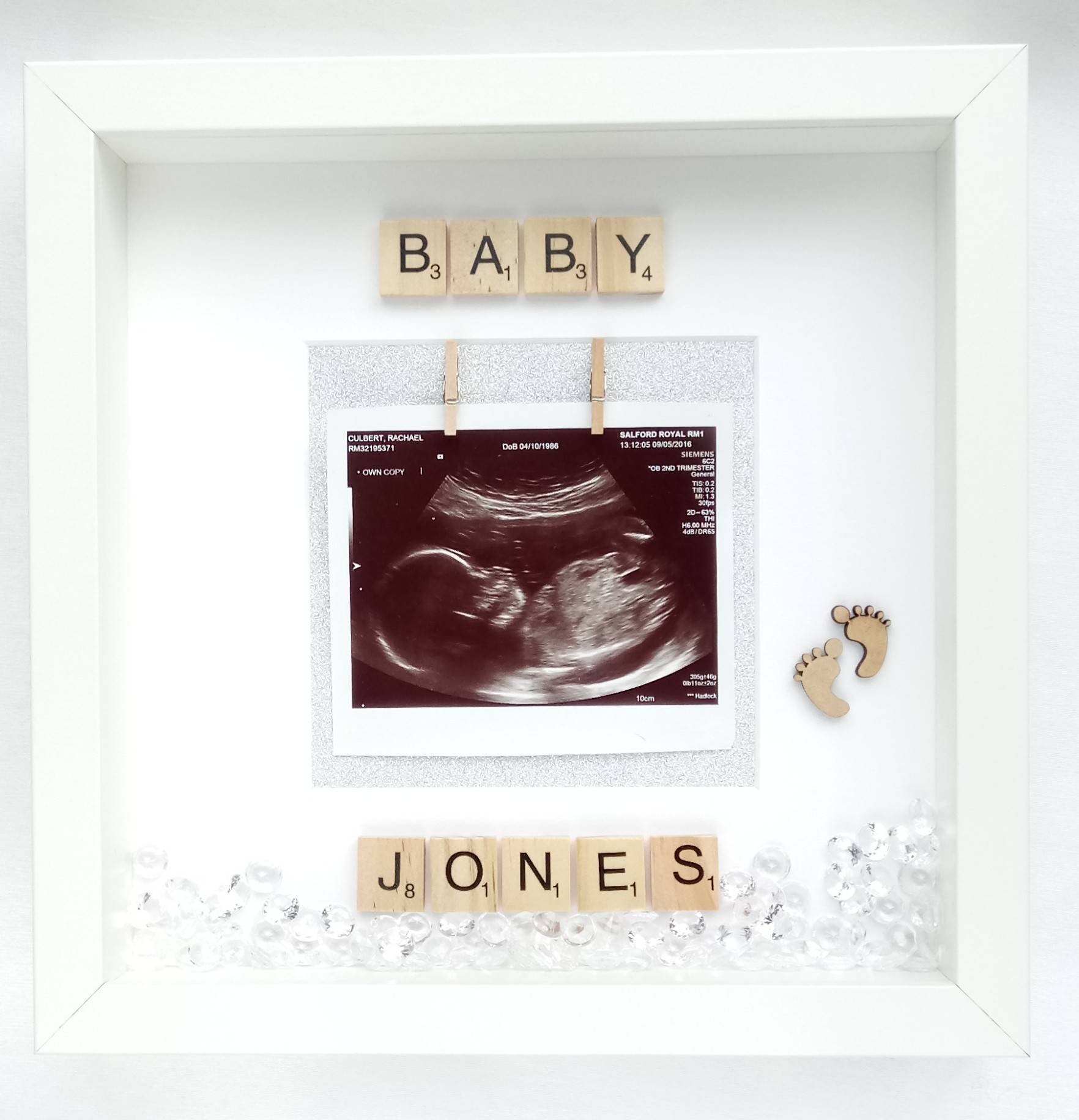 Baby Scan Frame Scan Frame Scan Photo Frame Baby Frame Etsy Canada