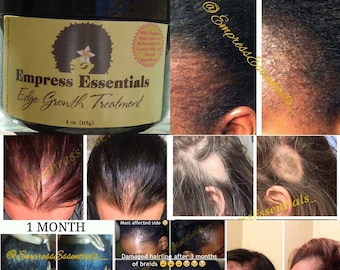 Hair Loss Treatment Hair growth Cream 2 Month Supply Balding Alopecia Thinning Edges Bald Spots For Men or Women Black Castor Oil