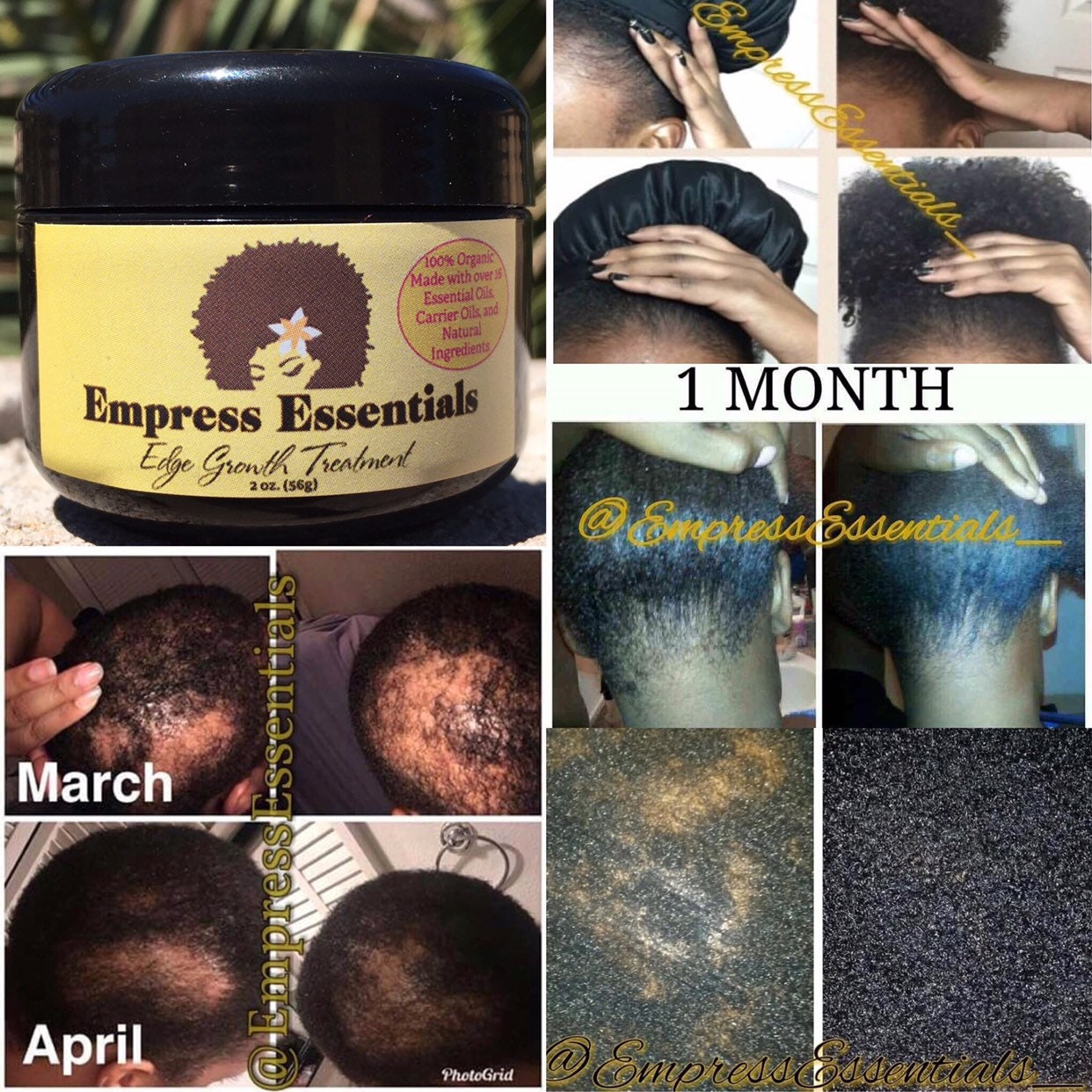 Hair Loss Treatment Hair Growth Cream 1 Month Supply Balding - Etsy