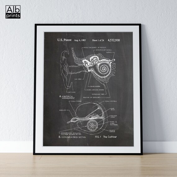 Cochlear Implant Patent Printable Audiologist Gift Medical | Etsy