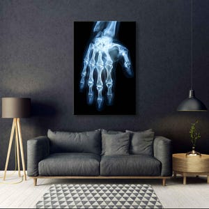 X-Ray Human Hand - Anatomy Wanddekor, Radiologie Foto Leinwand, moderne medizinische Kunstdruck