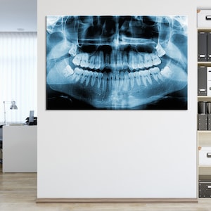 Panoramic Dental Tooth X-ray Canvas, Wall Art for Dental Office, Large Wall Decor