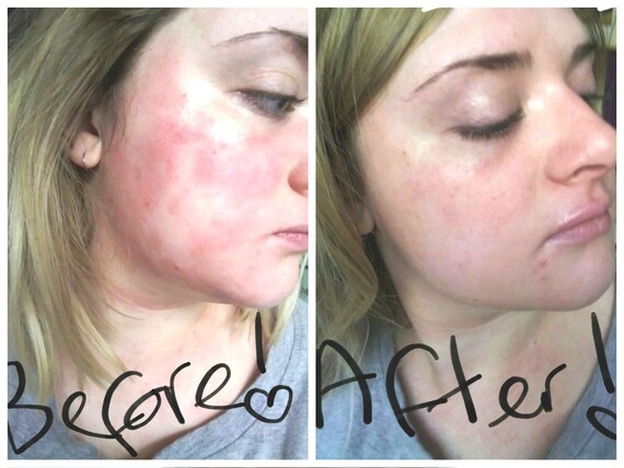 knee high leather wedge boots