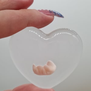 Aborto de memoria, 8 semanas de embarazo, niño estrella, embrión de corazón, aborto espontáneo de 8 semanas