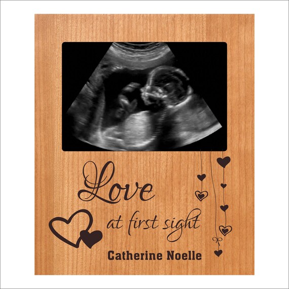 personalized ultrasound gifts