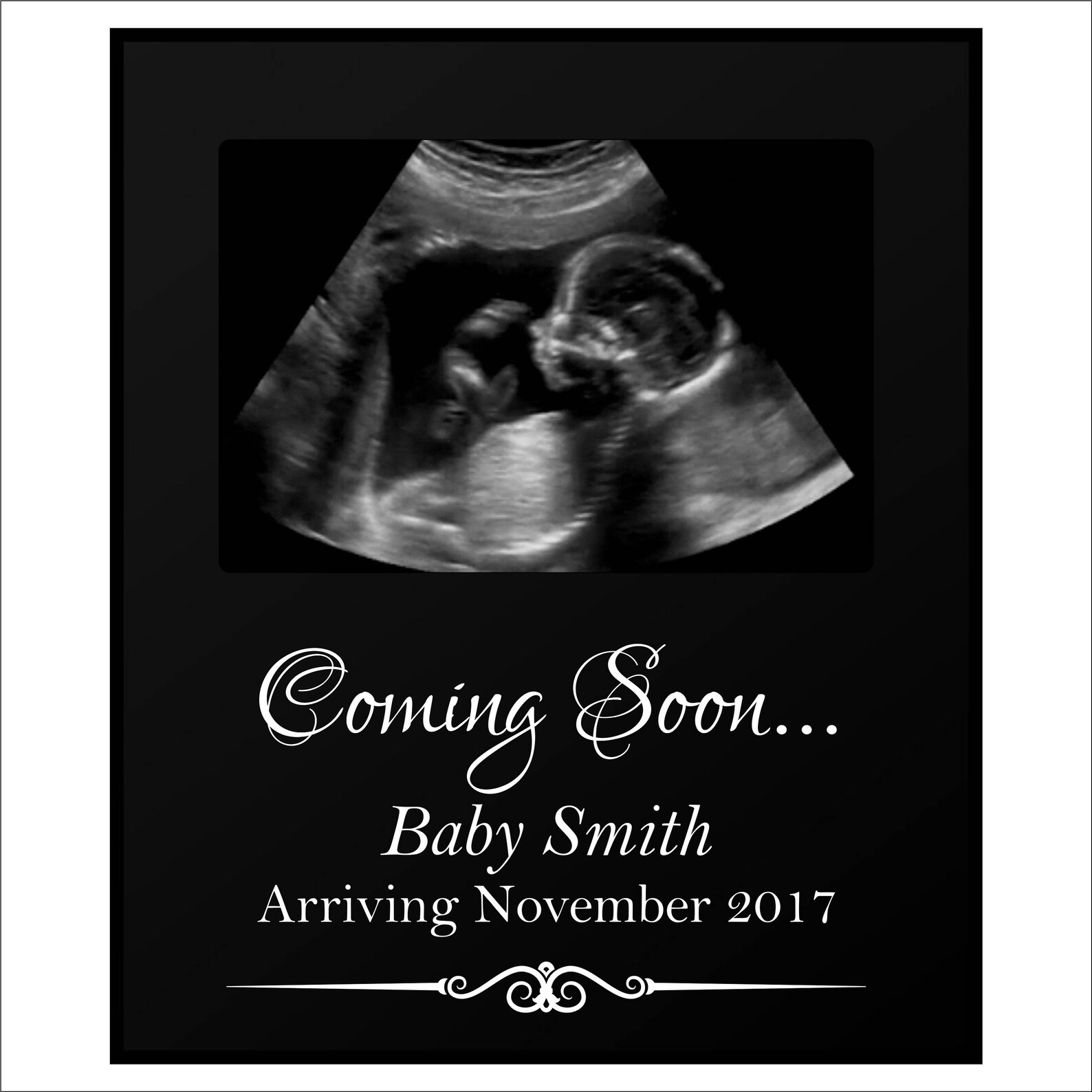 Personalized Ultrasound Frame Custom Baby Photo Frame Etsy
