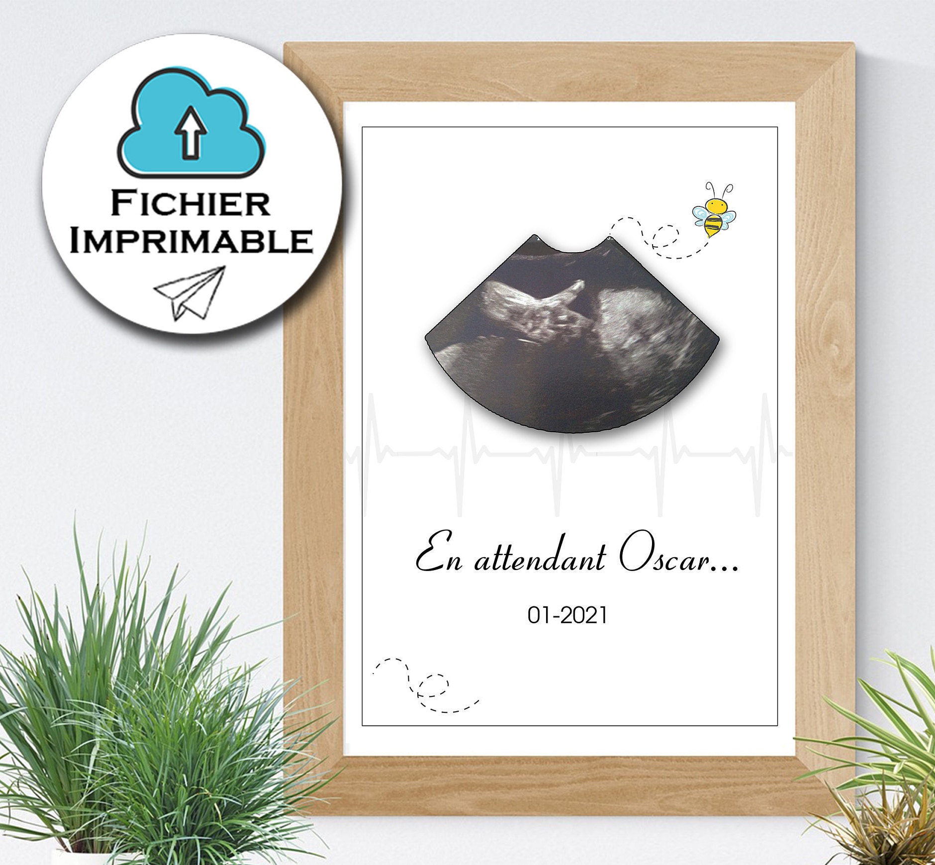 Affiche Échographie, Souvenir de Grossesse Personnalisé, Fichier à Imprimer