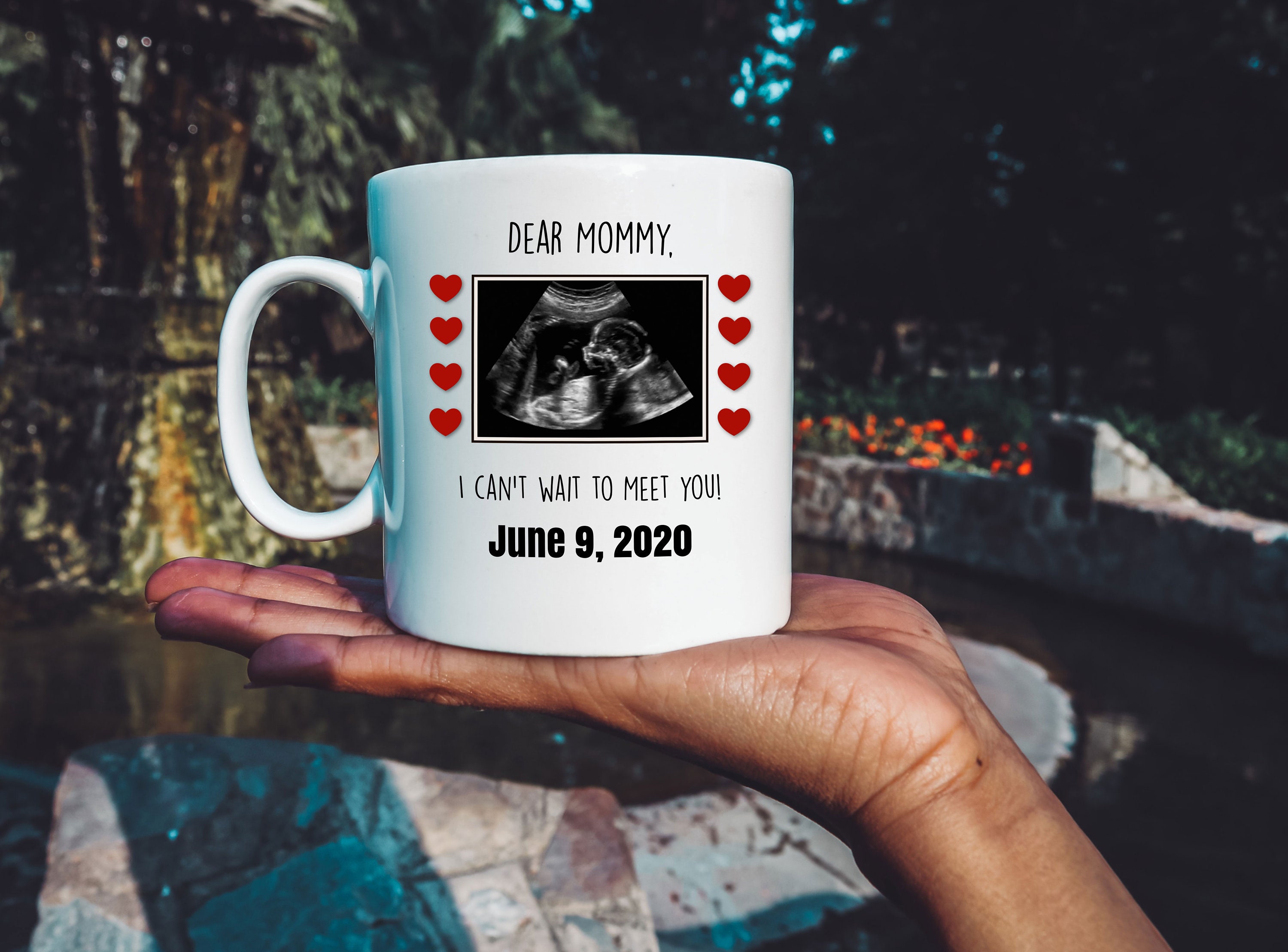 Ultrasound Mug Mom Sonogram Ultrasound Gift Ultrasound Etsy