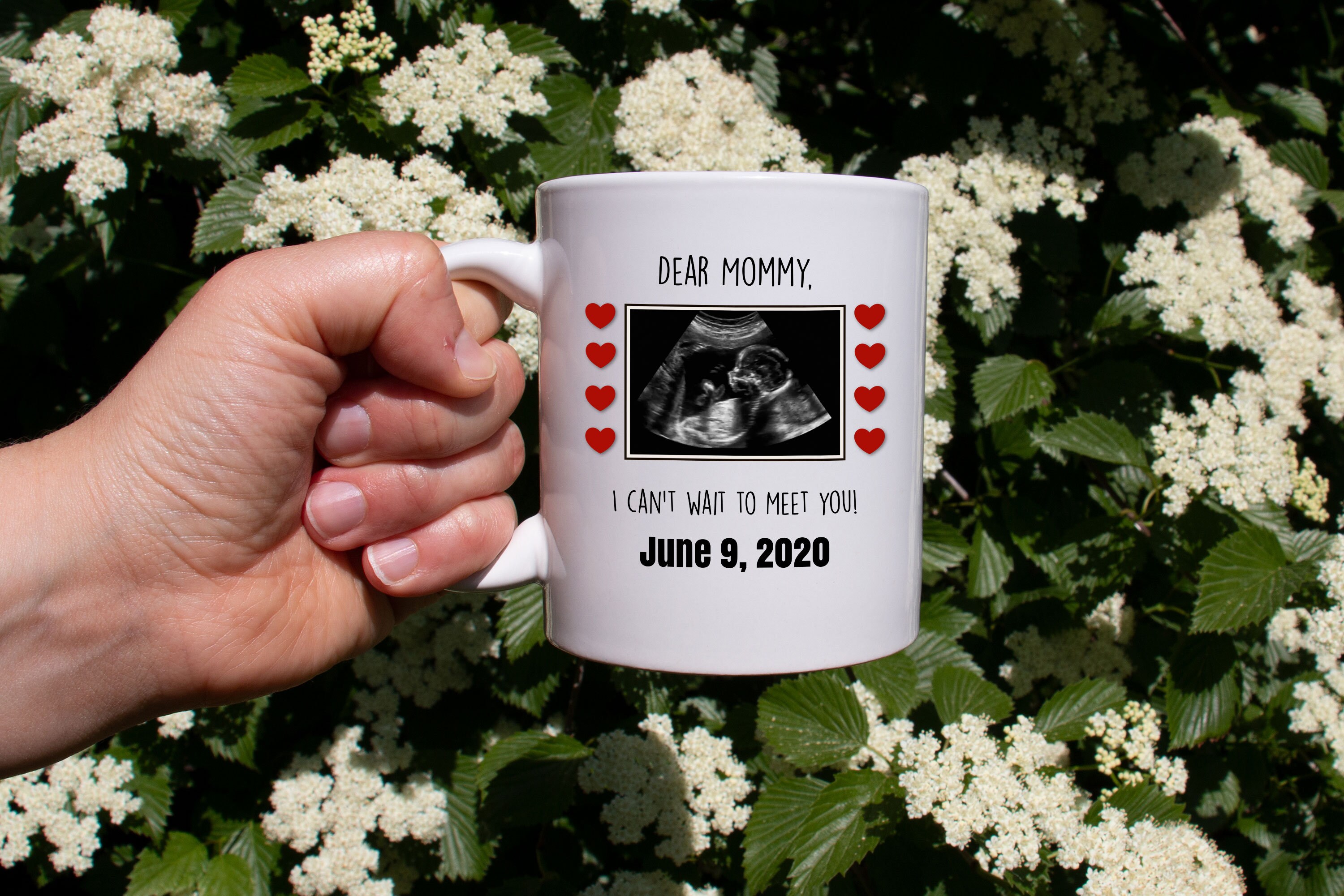 Ultrasound Mug Mom Sonogram Ultrasound Gift Ultrasound Etsy