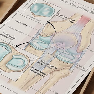 Arte médica, anatomia cirúrgica do joelho, arte de parede, ilustração médica, impressão, arte de parede ortopédica, cirurgia, anatomia do joelho, decoração médica, presente para médico