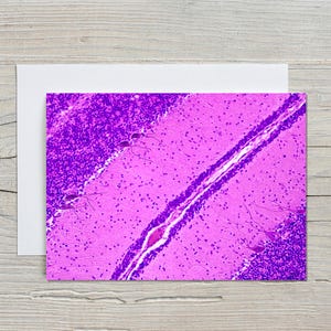 May include: A greeting card featuring a vibrant, close-up view of a microscopic tissue sample, showcasing a detailed, abstract pattern in shades of purple and pink. The card is set against a white background.
