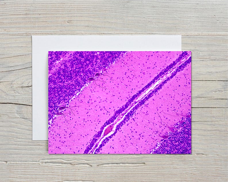 May include: A greeting card featuring a vibrant, close-up view of a microscopic tissue sample, showcasing a detailed, abstract pattern in shades of purple and pink. The card is set against a white background.