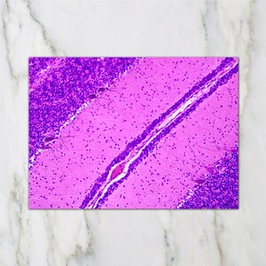 May include: A vibrant, close-up view of a histological slide, showcasing a section of brain tissue. The image features a striking contrast of deep purple and light pink hues, with intricate cellular structures visible throughout. The slide is rectangular.