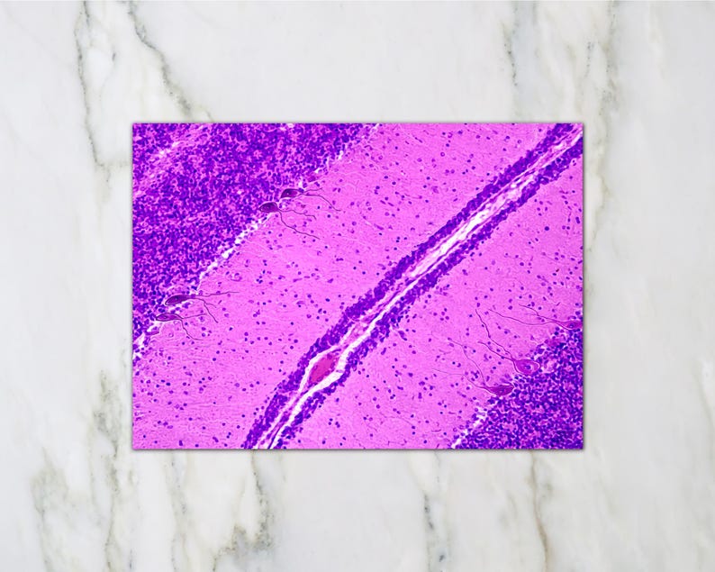 May include: A vibrant, close-up view of a histological slide, showcasing a section of brain tissue. The image features a striking contrast of deep purple and light pink hues, with intricate cellular structures visible throughout. The slide is rectangular.