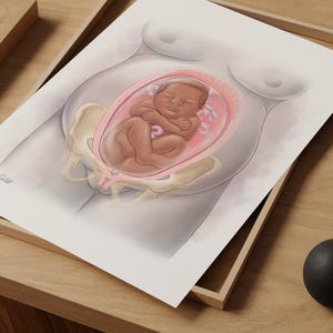 OBGYN Pregnancy Medical Wall Art, Womb Art Print, Breech Baby Pregnancy Wall Art, Labor and Delivery Wall Art Gift for Midwife Gynecologist