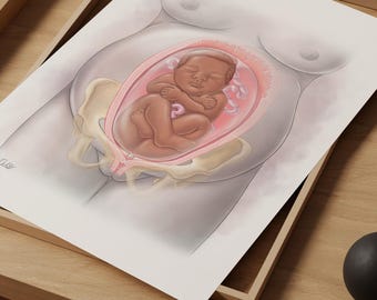 産婦人科の妊娠医療ウォールアート、子宮アートプリント、逆子妊娠ウォールアート、出産ウォールアート、助産師婦人科医へのギフト