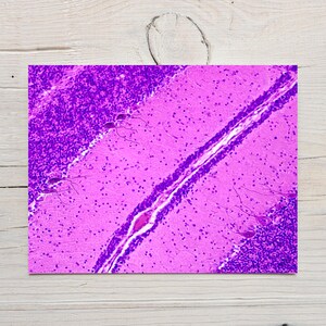 May include: A microscopic image of a biological sample, showcasing a cross-section of tissue. The image is predominantly pink and purple, with distinct cellular structures and patterns. The sample appears to be a section of the brain.