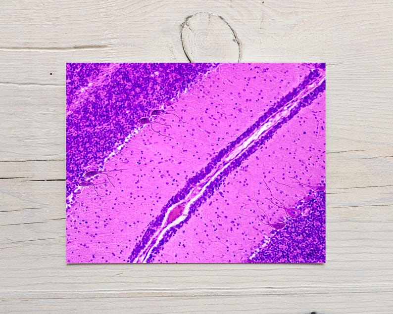 May include: A microscopic image of a biological sample, showcasing a cross-section of tissue. The image is predominantly pink and purple, with distinct cellular structures and patterns. The sample appears to be a section of the brain.