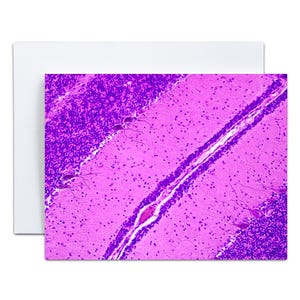 May include: A greeting card featuring a microscopic image of brain tissue. The image is predominantly pink and purple, with detailed cellular structures visible. The card has a white border.