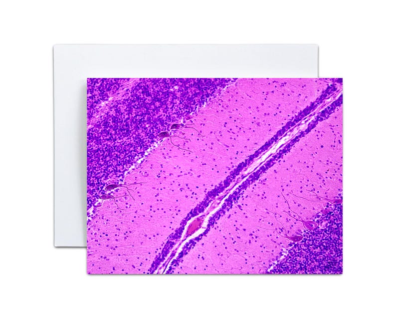 May include: A greeting card featuring a microscopic image of brain tissue. The image is predominantly pink and purple, with detailed cellular structures visible. The card has a white border.