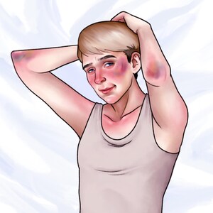 May include: A digital illustration of a person with short blonde hair wearing a light beige tank top. The figure has visible purple and blue bruising on the skin around the eyes and on the elbows, with flushed red cheeks and a neutral expression.