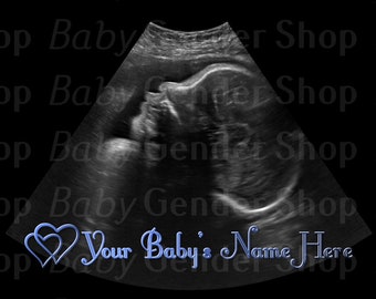Download Free Gender Reveal Baby Boy Sonogram Picture / Your Baby's Name Here / Instant Download / Baby Shower/ Baby Gifts / MockUps / Stock Photo PSD Template