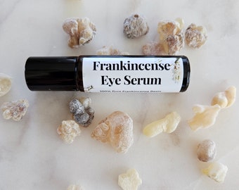Organic Frankincense Under Eye Serum |Castor Oil Roller | Vegan Skin Care | Eye Care | Handmade skin care gift for her | Clean Beauty