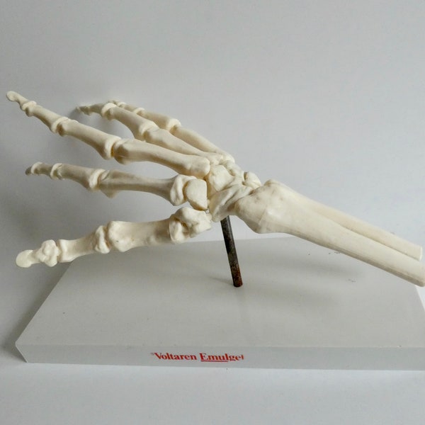 Anatomisches Hand Modell Werbung von Voltaren aus den 90er Jahren - Skelett Knochen Modell - Lern Anatomie