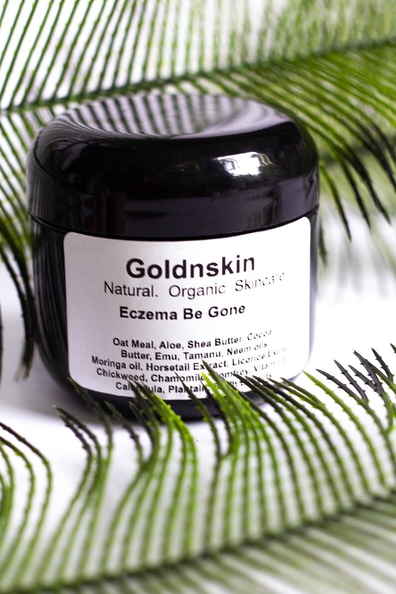 Eczema Soothing Cream Itchy Rash Baby Acne Heat Rash Etsy