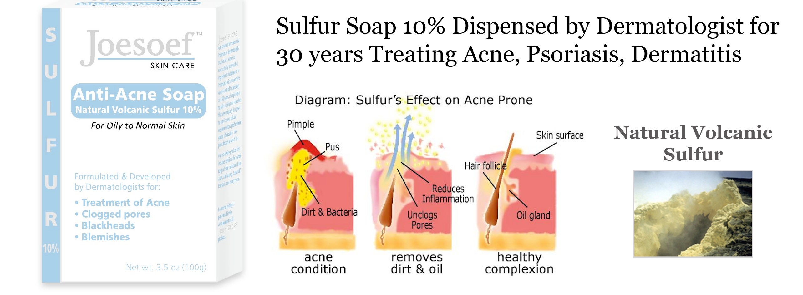 Sulfur Soap 1 Sulfur Soap Joesoef Skin Care Acne Treatment Etsy UK