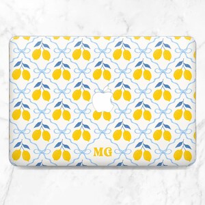Macbook case lemon Cute custom print Personalized case Your initials here Yellow Blue Macbook case summer 2026 Air 15 Air 13 Pro 14 Pro 16