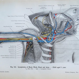 Antique Anatomy Print PAEDIATRIC LYMPHATIC SYSTEM  Original  Lithographed Print 1906