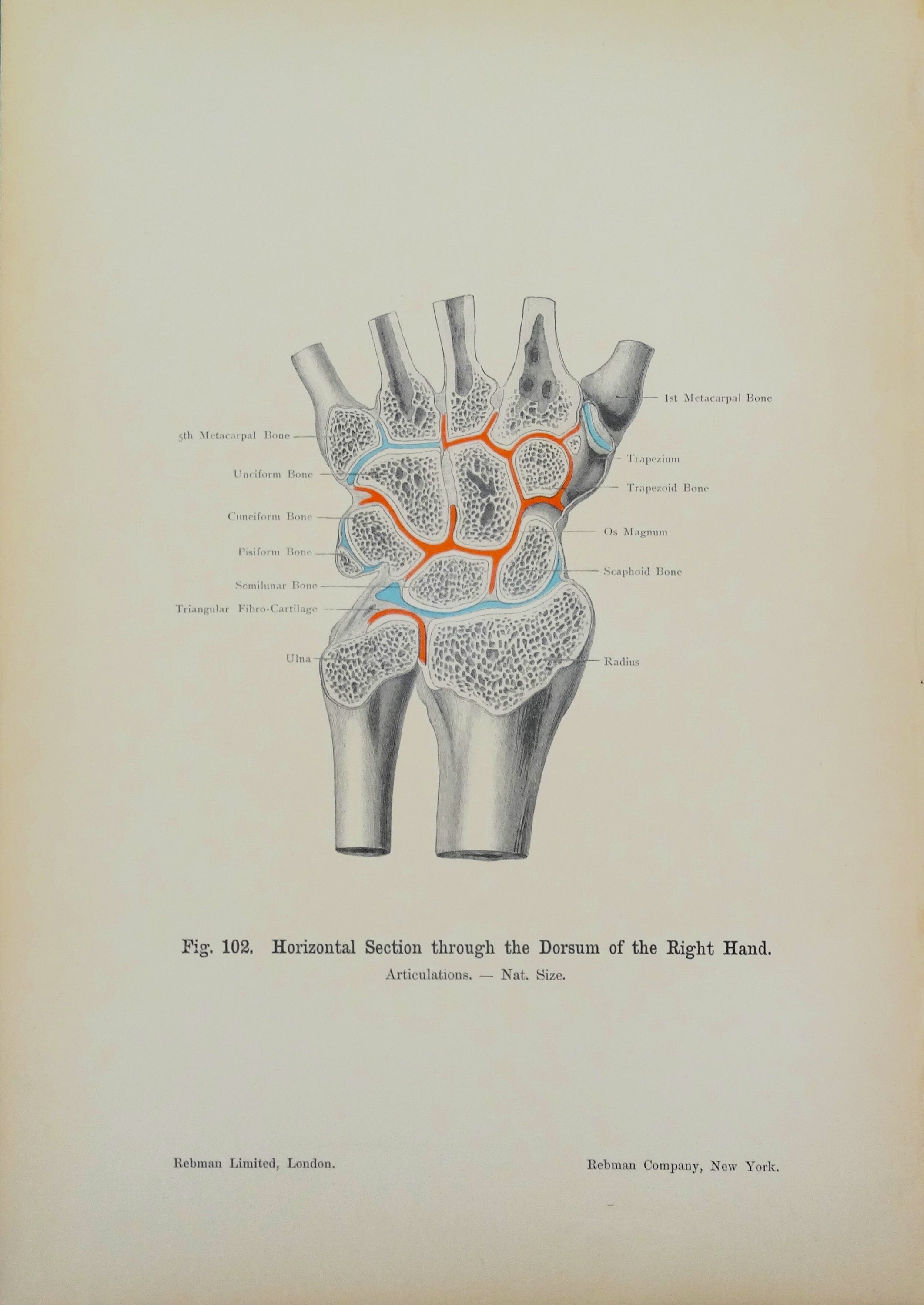 Articulación radiocarpiana: Huesos,ligamentos,movimientos | Kenhub, image size:2124x3000