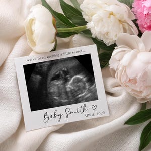 Anuncio de embarazo con ecografía sencilla: Revelación del bebé personalizable (descarga digital) imagen 1