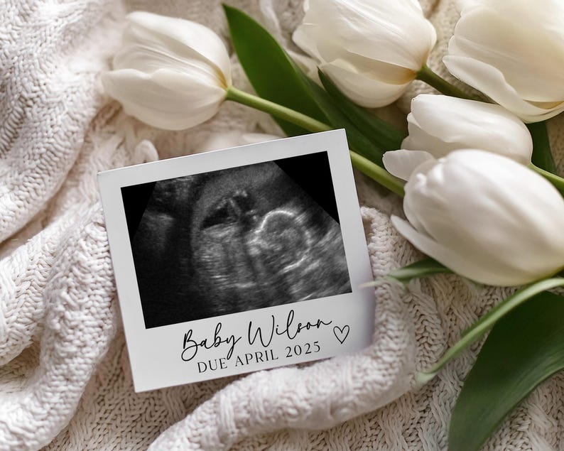 May include: A white frame with a black and white ultrasound image of a baby. The text "Baby Wilson" and "Due April 2025" is written below the image.